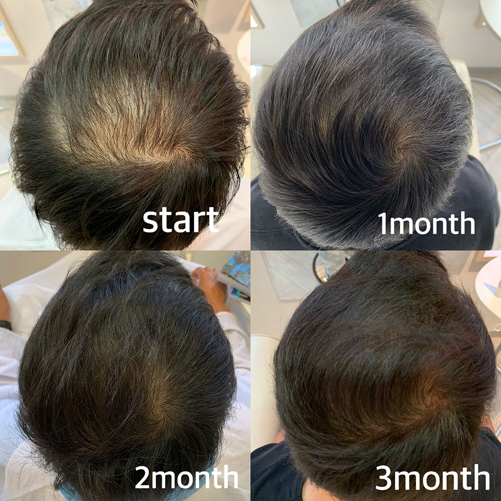 お客様のBefore&Afeter