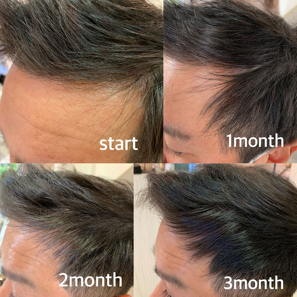 お客様のBefore&Afeter